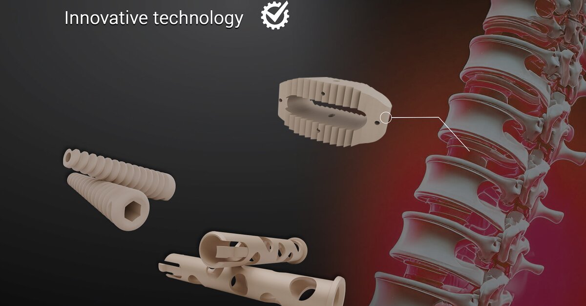 Innovative PEEK injection moulding technology for cost-effective ...